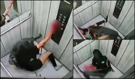 Momentul în care o tânără de 25 de ani este atacată de câinele ei, un pitbull. Cum a reuşit să scape cu viaţă